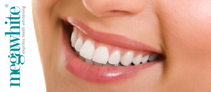 pääkuva Hampaiden valkaisuhoito